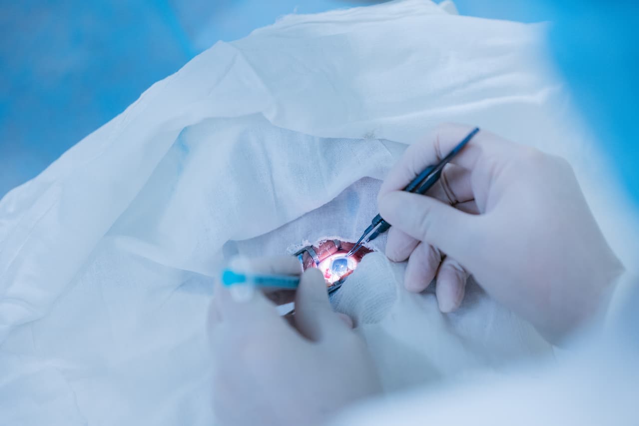 Augenoperation Kosten sparen durch Behandlung im Ausland