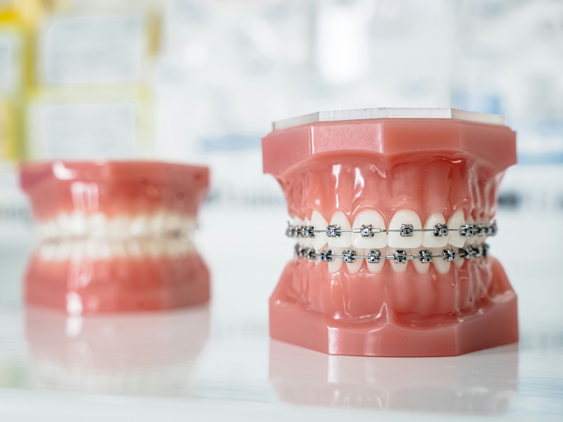 Festsitzende Kieferorthopädie / Brackets