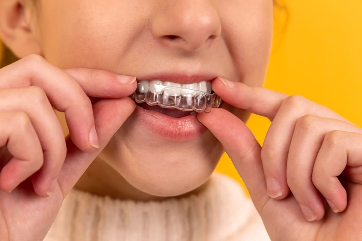 Full-Mouth-Rehabilitation